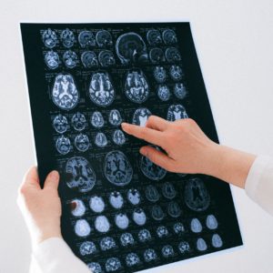doctor examining brain